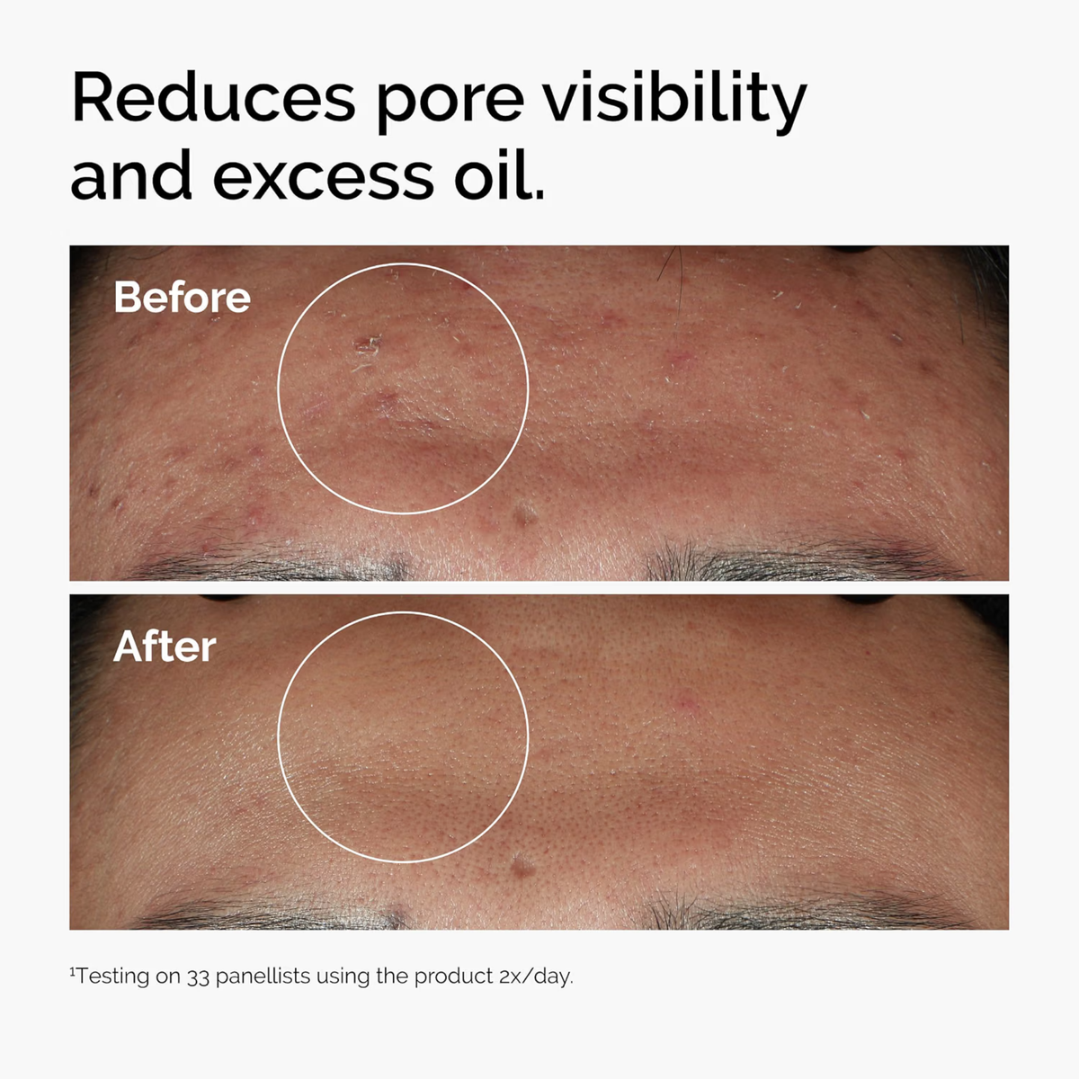 The Ordinary Niacinamide 10, image 3