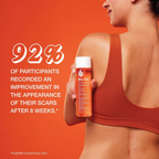 Bio Oil 60ML