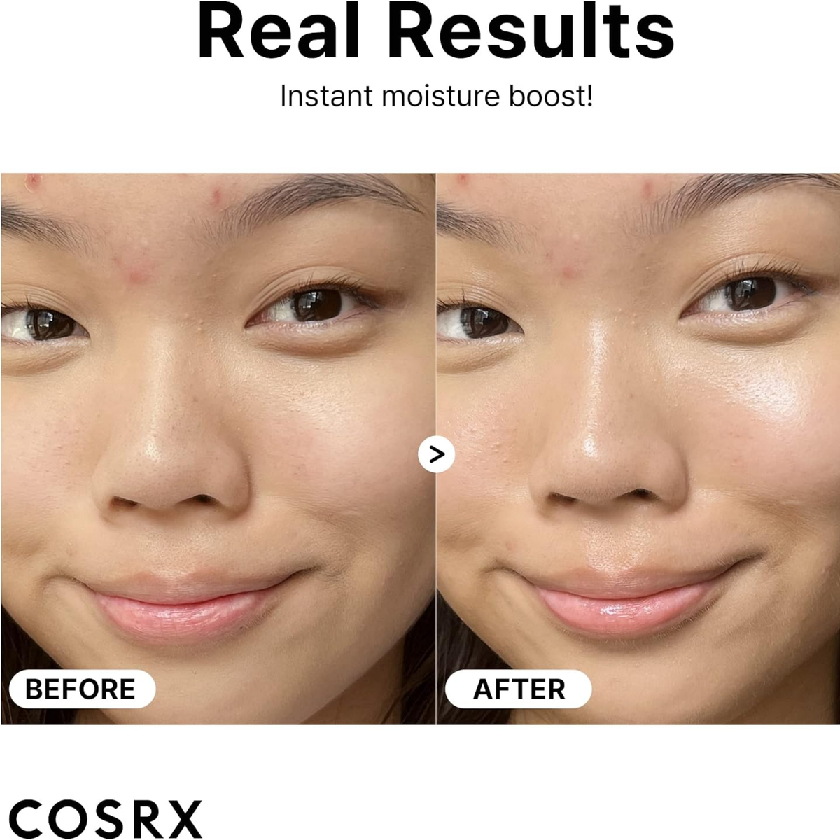 COSRX Pure Hyaluronic acid 3% Serum 20ML, image 3
