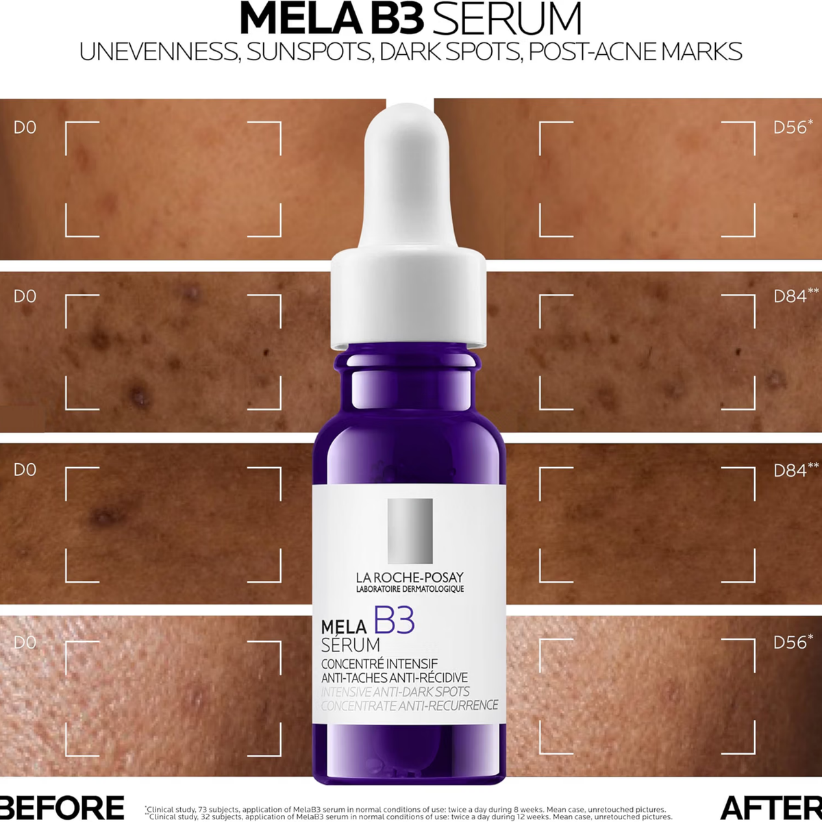 La Roche-Posay MelaB3 Serum Intense Anti-dark spot serum 15ML, image 2