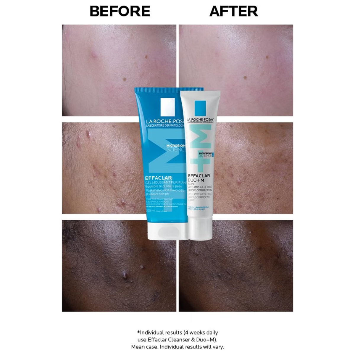 Effaclar Duo+M Anti-Breakout Corrective Gel 40ML, image 7